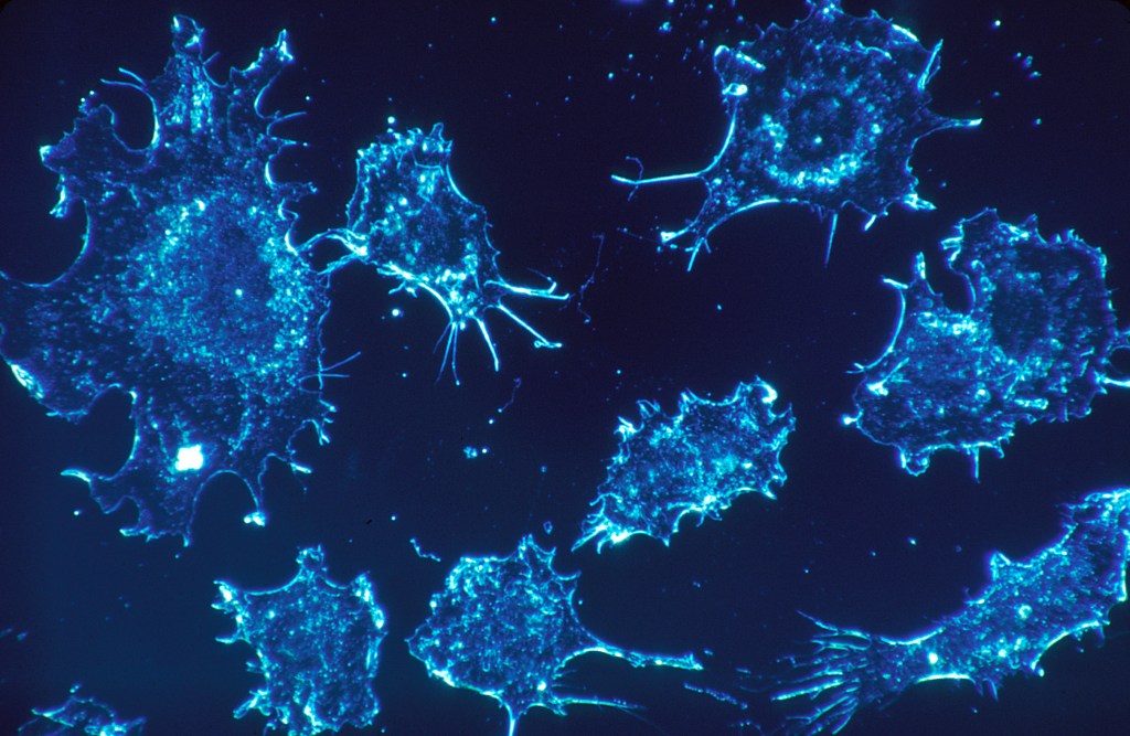 VA plans massive expansion of cancer treatment options