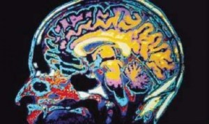 VA doubling back to resolve TBI claims denials
