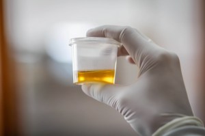 Urine sample odor that prompted evacuation of VA medical center was actually vinegar