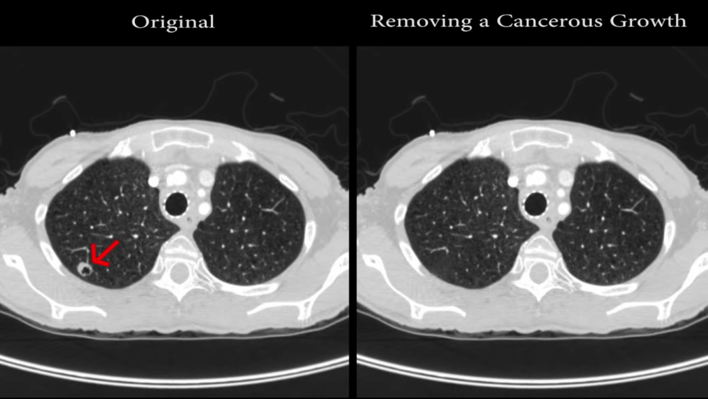 If hackers can hide tumors in scans, what else can they hide?