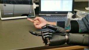 Ultrasound technology could improve use of prosthetics