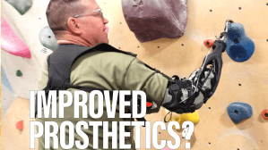 Prosthetics made from running shoes? Meet “Stumpworx”